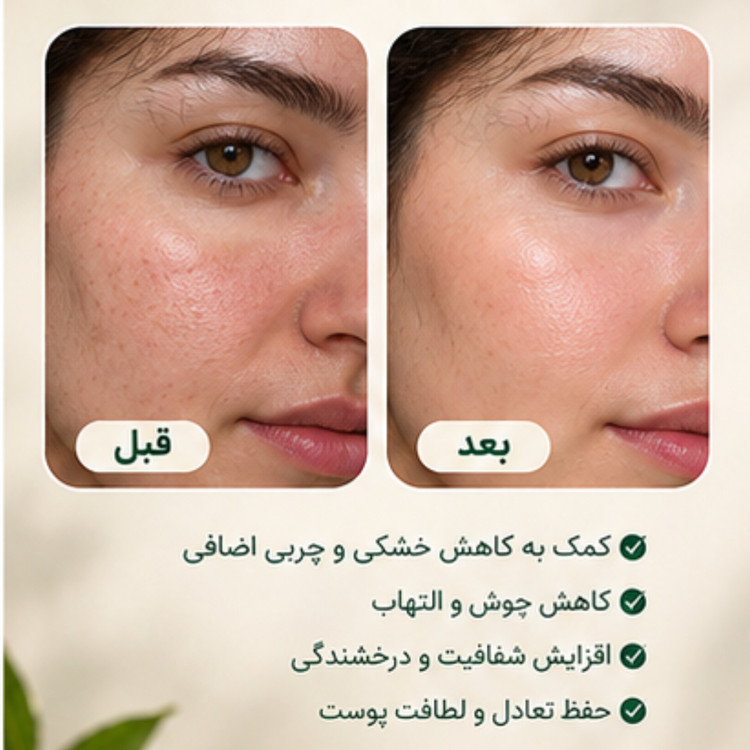 سرم بالانس پوست مهرکده سلامتی متعادلکننده پوست | ۳۰ میلیلیتر